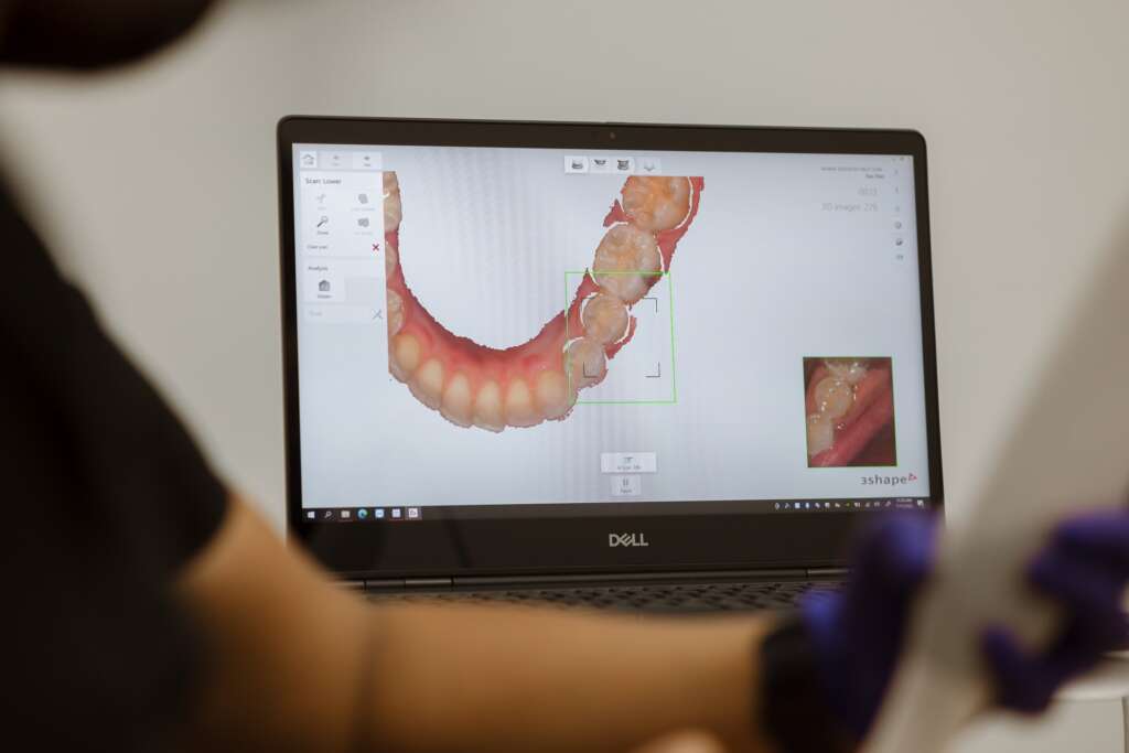 Orthodontic Treatment