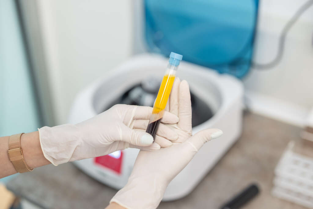 Close up od doctor's hands while preparing blood collection tubes for centrifuge machine