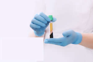 Platelet-Rich-Plasma Therapy
