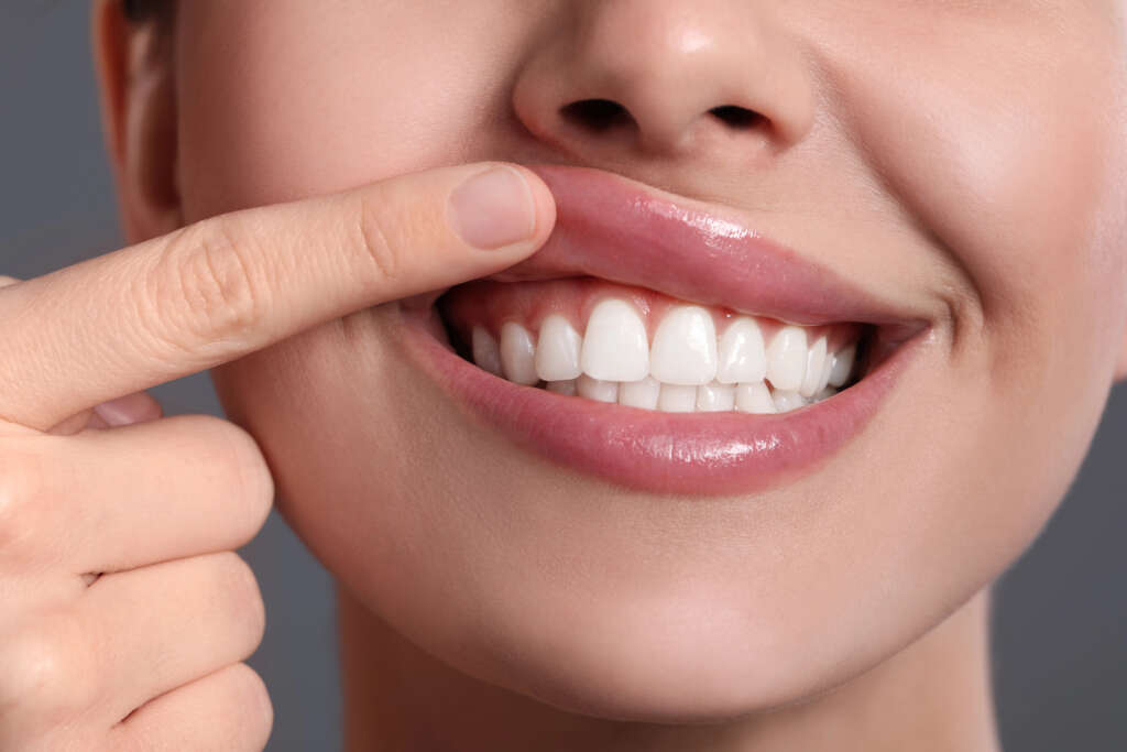 Connective Tissue Grafts